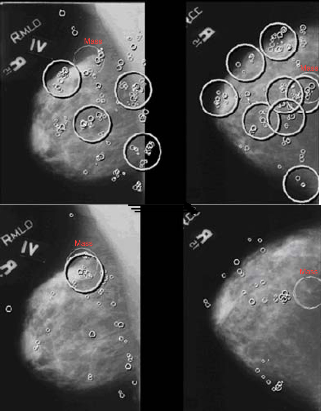 Eye-tracking recordings for a two-view digital mammogram. The top row is an inexperienced observer while the bottom row is an expert radiologist. The left column shows MLO views while the right column shows CC views.